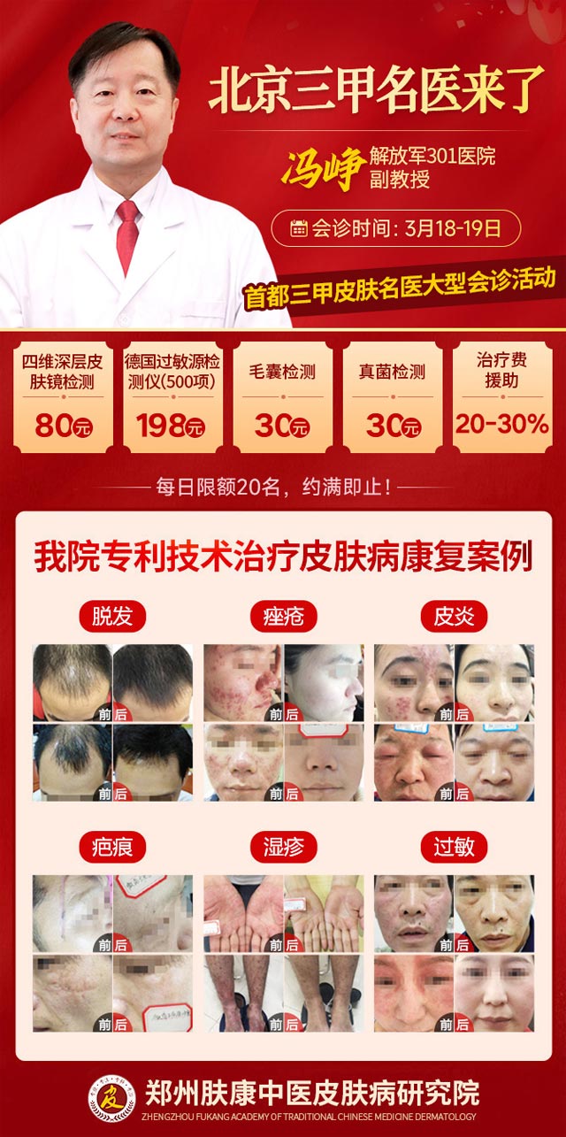 【郑州肤康】特邀北京解放军301医院冯铮副教授坐诊