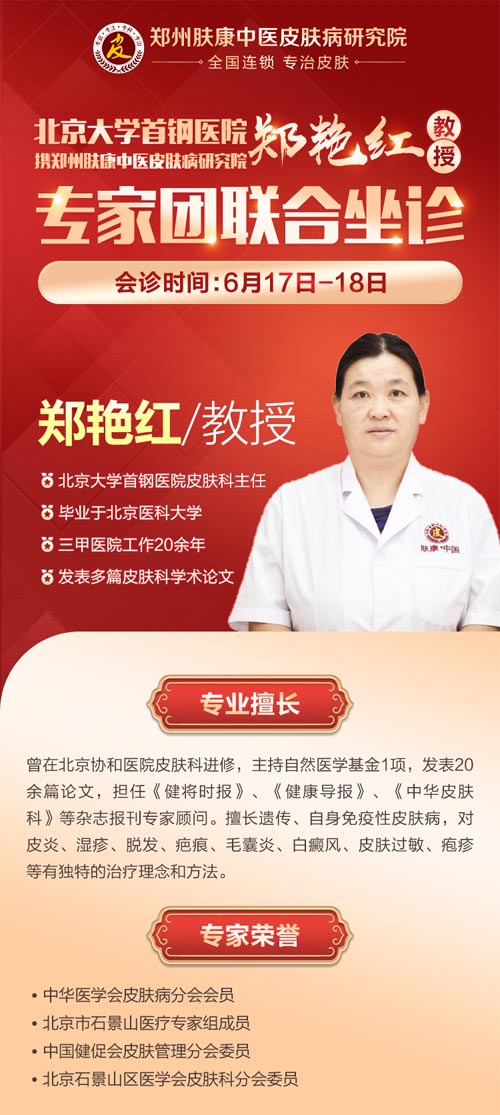 重磅消息:6月17至18郑州肤康特邀郑艳红教授联合会诊