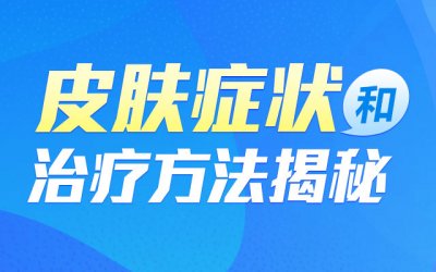 身体上有红疹是什么原因？郑州肤康皮肤医院为您解答